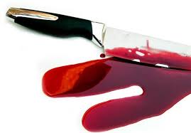 از دستگیری پزشک قلابی تا جدا شدن چرخ هواپیما هنگام فرود+فیلم از دستگیری پزشک قلابی تا جدا شدن چرخ هواپیما هنگام فرود+فیلم