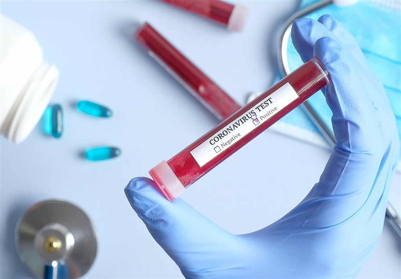 هزینه دولتی تست کرونا به ازای هر ورزشکار ۲۶۰ هزار تومان هزینه دولتی تست کرونا به ازای هر ورزشکار ۲۶۰ هزار تومان