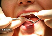 پویش ملی دهان و دندان در خراسان شمالی